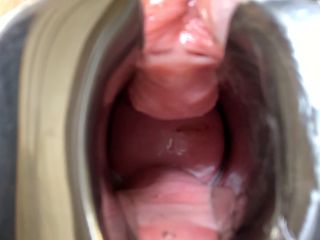 Speculum In My Wery Wet Pussy-2