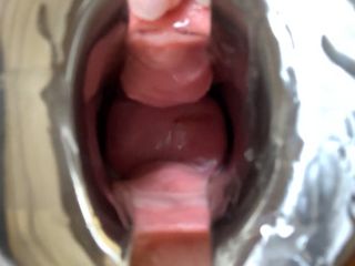 Speculum In My Wery Wet Pussy-8