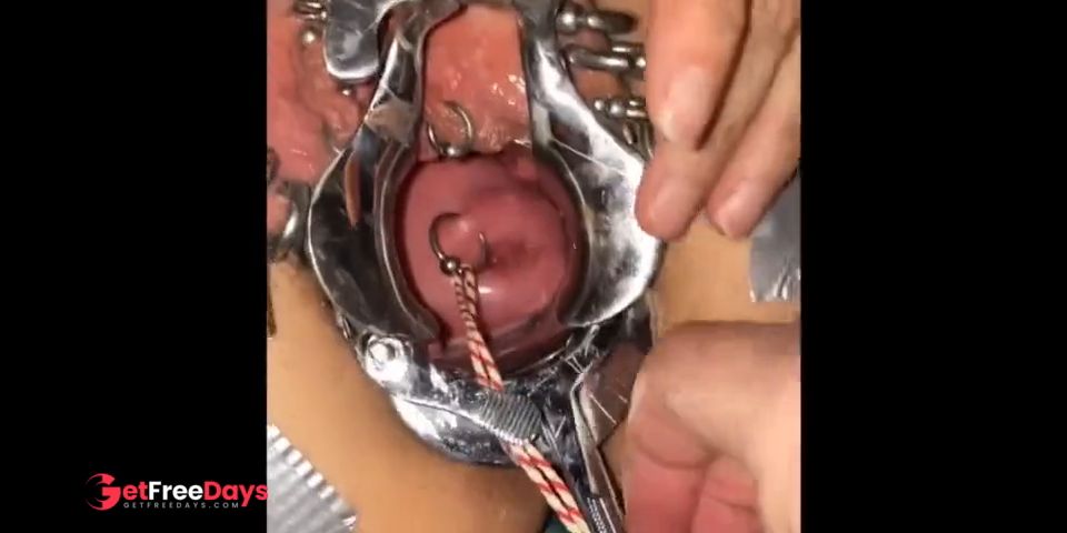 [GetFreeDays.com] Extreme cervix sounding Porn Leak December 2022