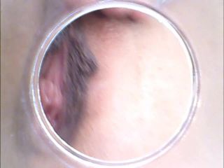 RAW endoscopic video-4