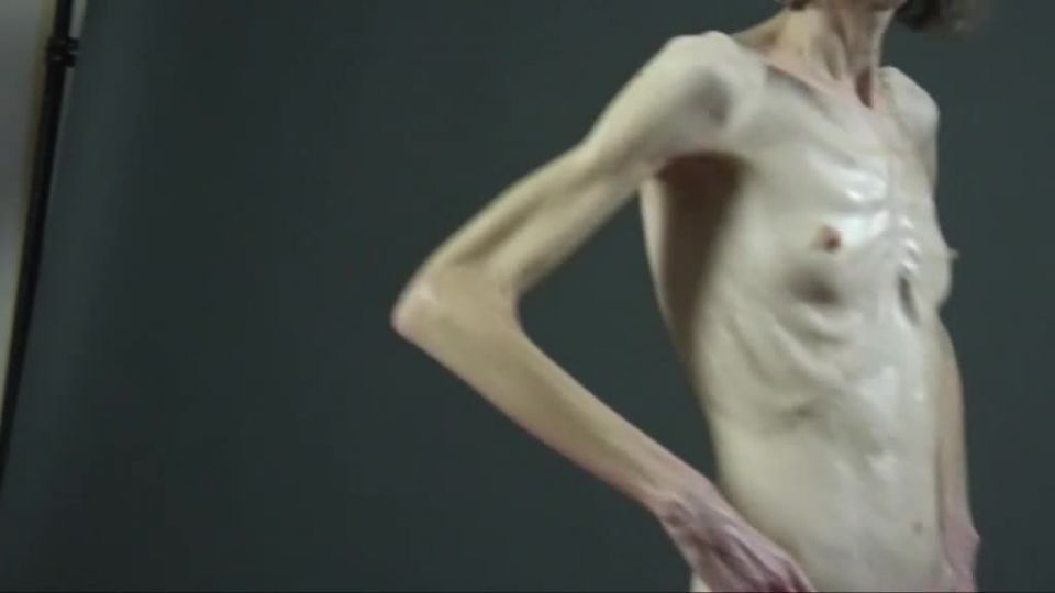 Anorexic 1200-sonja carmen