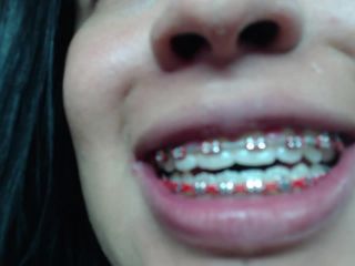 M@nyV1ds - mia_isabella3 - Braces, mouth, uvula fetish-1