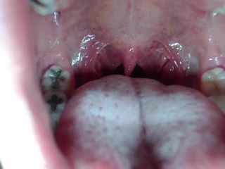 M@nyV1ds - mia_isabella3 - Braces, mouth, uvula fetish-5