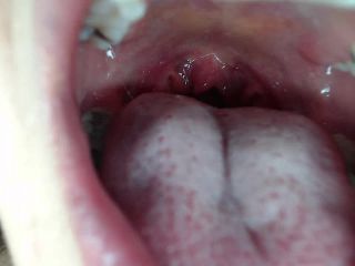M@nyV1ds - mia_isabella3 - Braces, mouth, uvula fetish-6