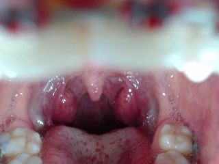 M@nyV1ds - mia_isabella3 - Braces, mouth, uvula fetish-7