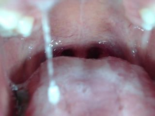 M@nyV1ds - mia_isabella3 - Braces, mouth, uvula fetish-8