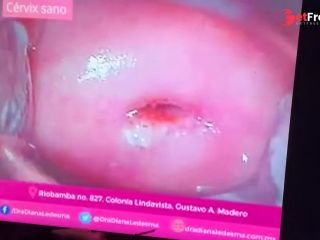 [GetFreeDays.com] AS ES UNA VULVA  ANATOMA Y TIPOS  VULVAS REALES Porn Video December 2022-4