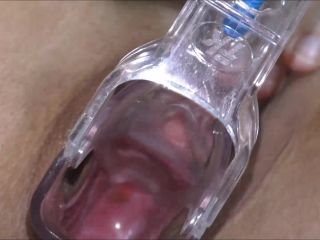 M@nyV1ds - Helena_Moeller - Cummed with speculum in pussy-8