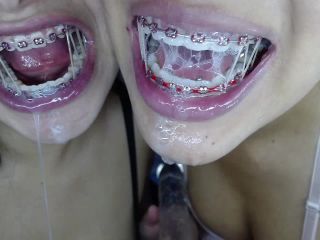 M@nyV1ds - mia_isabella3 - Extreme blowjob with braces-7